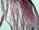 fig. 1      eosina x 
