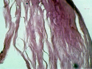 fig. 1      eosina x 